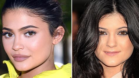 kylie jenner vorher nachher bilder|Kylie Jenners Transformation Gallery: See Before